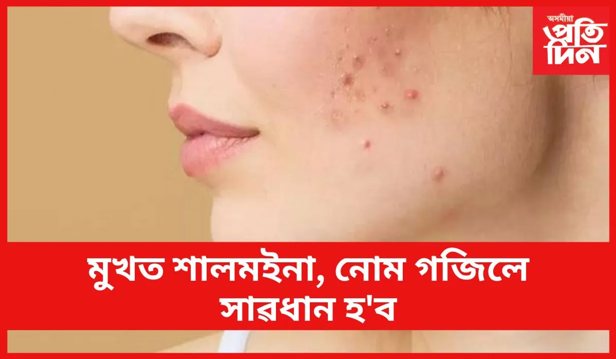 এইসমূহ উপেক্ষা কৰিলে আপুনি ভূগিব লাগিব গুৰুতৰ স্বাস্থ্য সমস্যাত